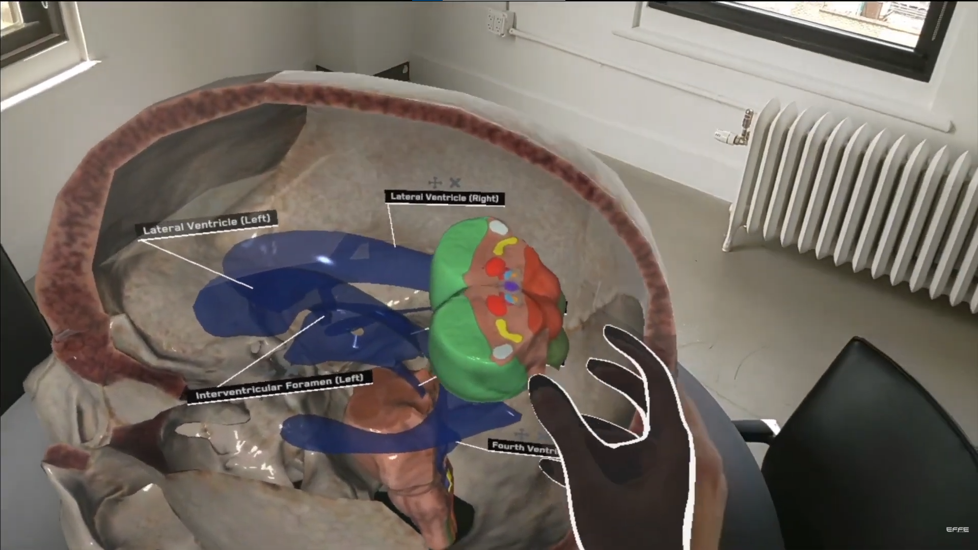 Augmented Reality in Anatomy , Augmented Reality In Human Anatomy