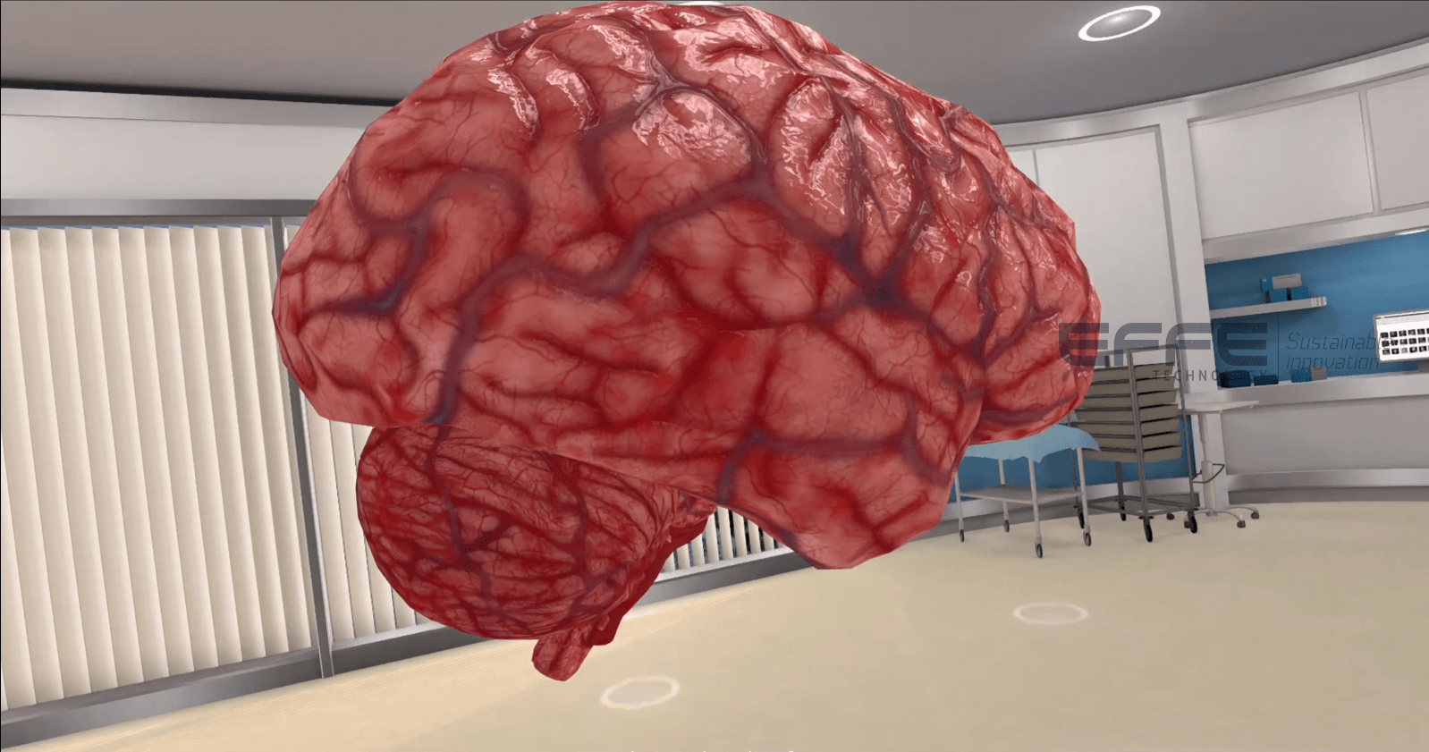 Brainstem Neuroanatomy