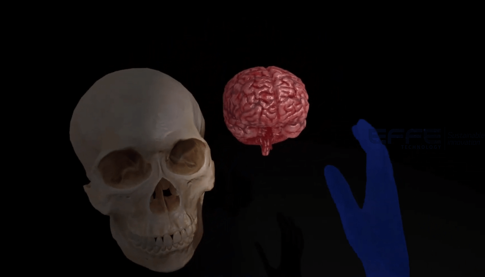 Brainstem Neuroanatomy