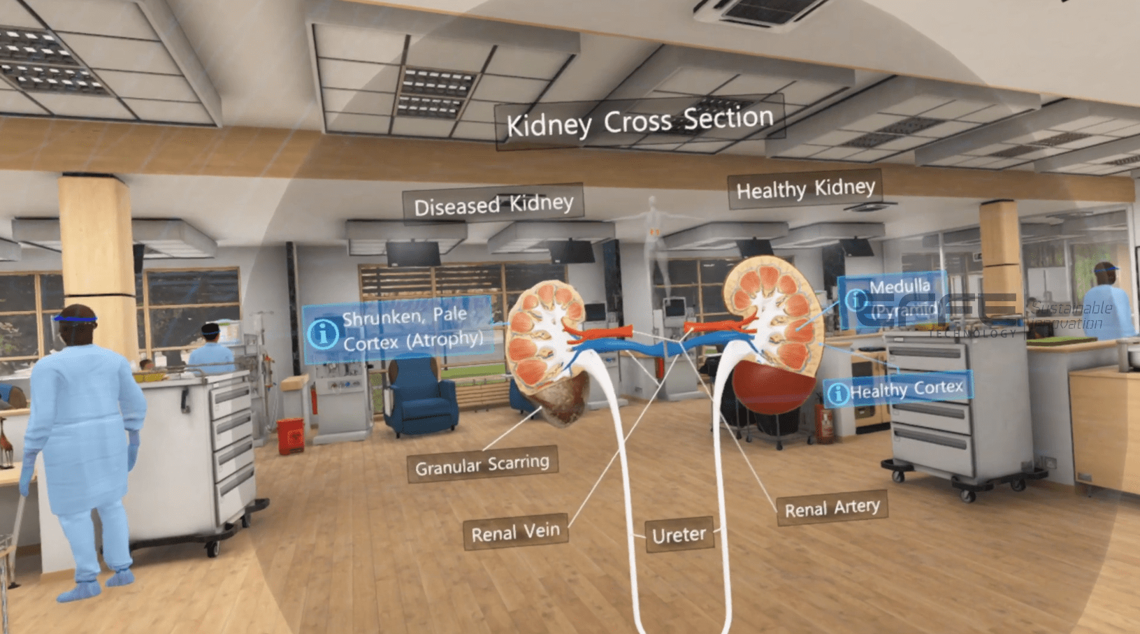 kidney anatomy VR