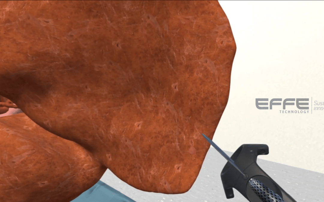 Liver Surgery VR Simulation for Surgical Centers: Real-Time Hepatic Anatomy & Procedure Training