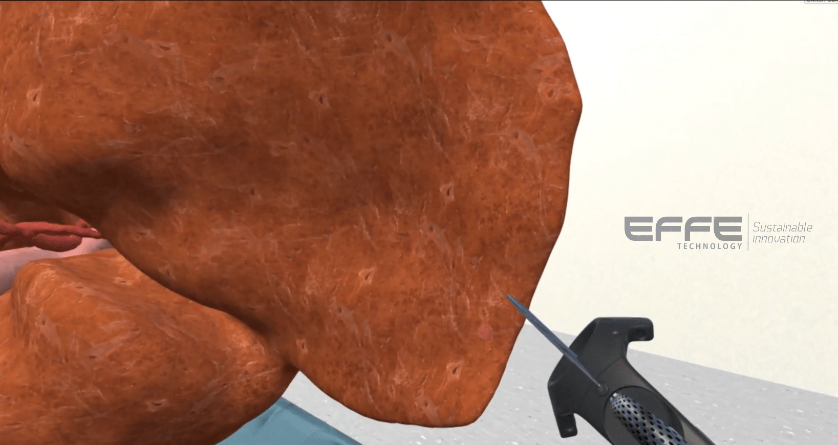 liver surgery VR simulation