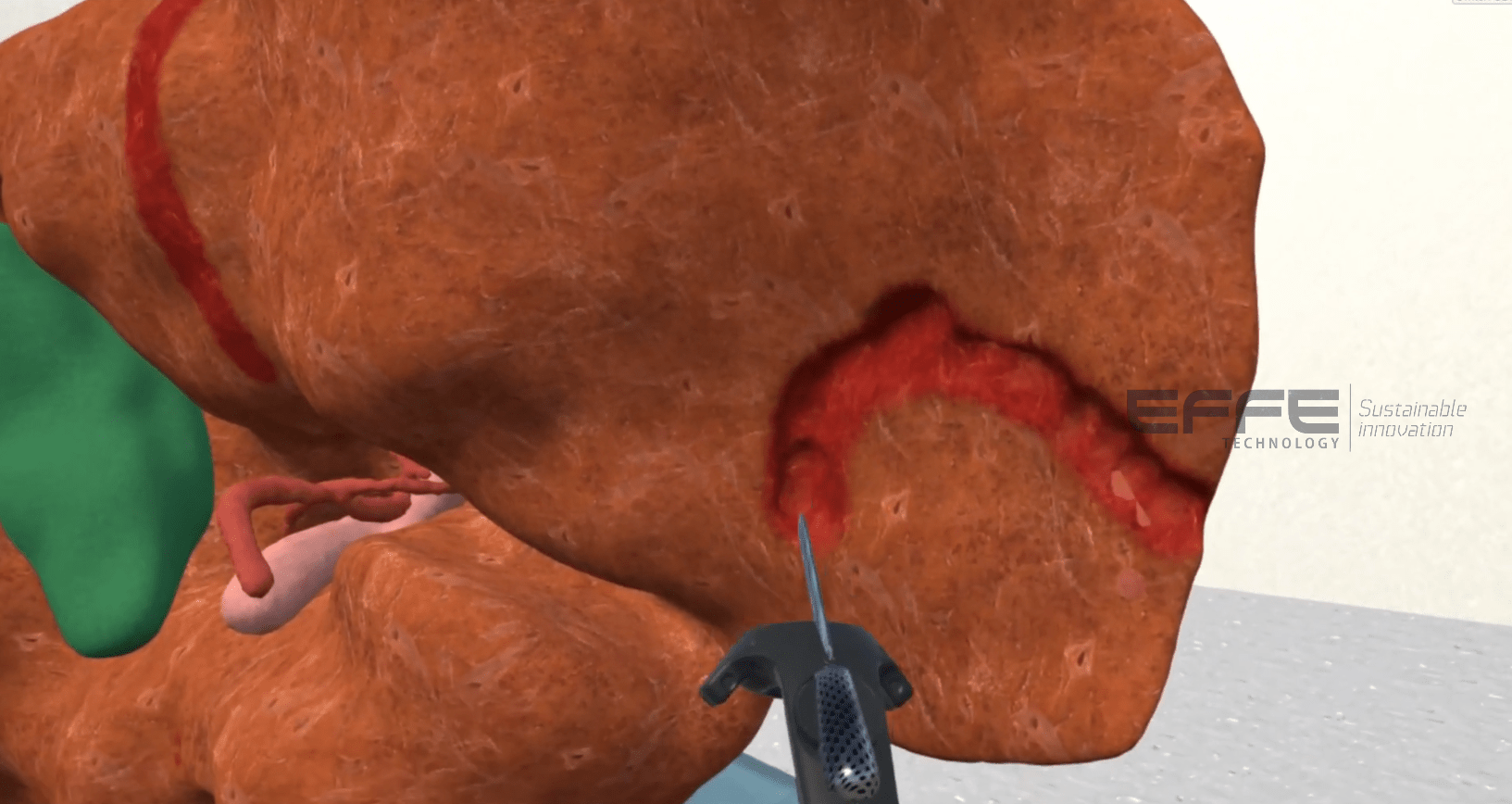 liver surgery VR simulation