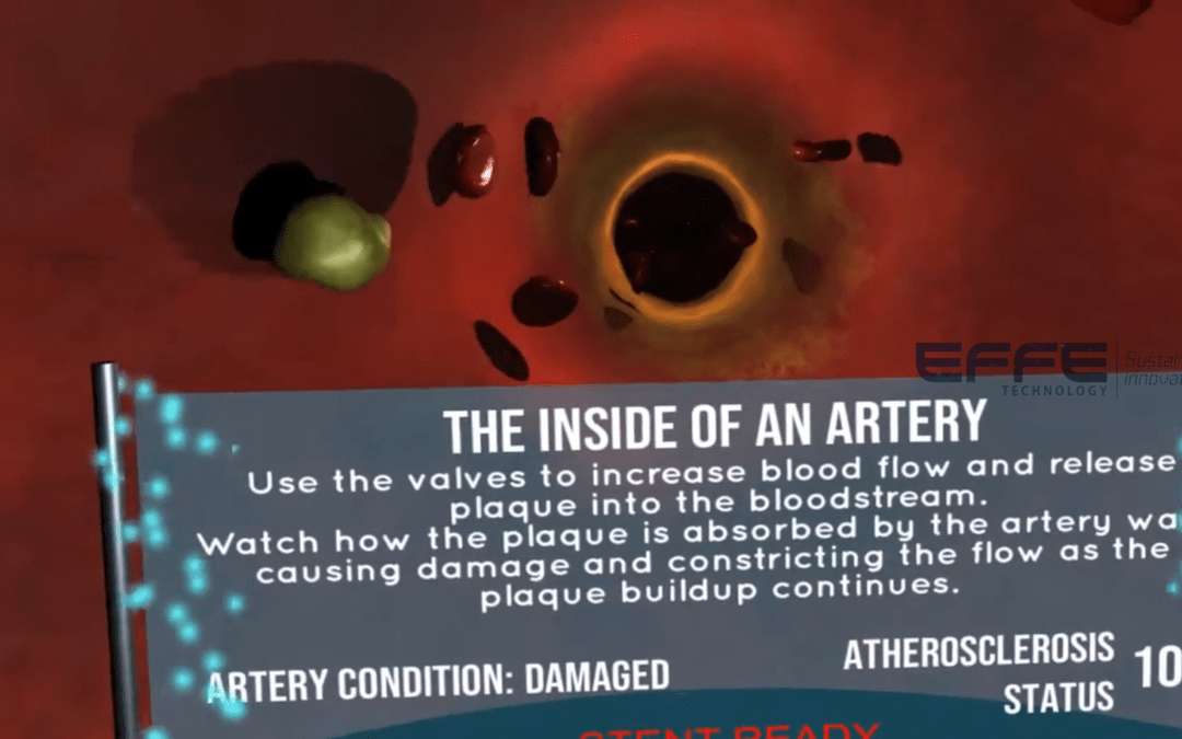Virtual Reality Cardiovascular Disease Training Platform | 3D Cardiovascular Disease Visualization System