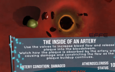 Virtual Reality Cardiovascular Disease Training Platform | 3D Cardiovascular Disease Visualization System