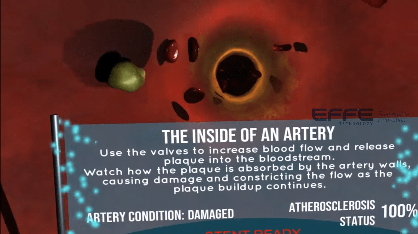 virtual reality cardiovascular disease