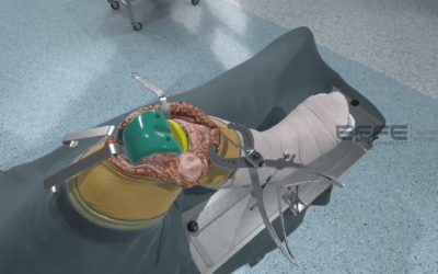 Orthopedic VR Training for Knee Procedures | Safe, Repeatable Surgical Practice in VR