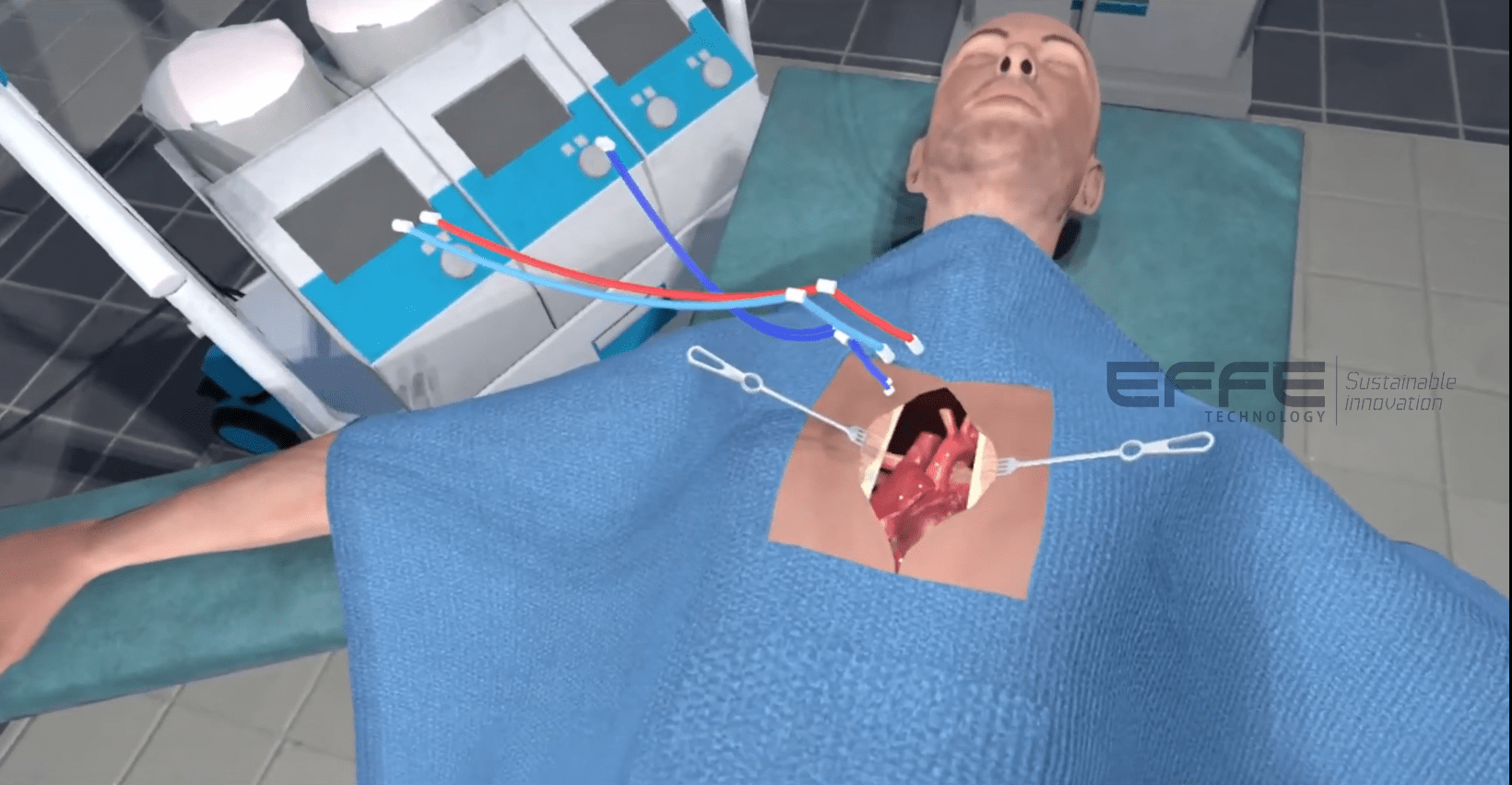 pre-operative cardiovascular surgery VR simulation