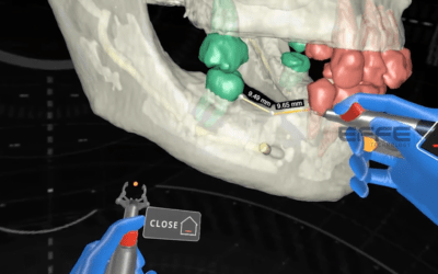 Portfolio: Virtual Reality Dental Surgery Simulator | Advanced Implantology VR Training