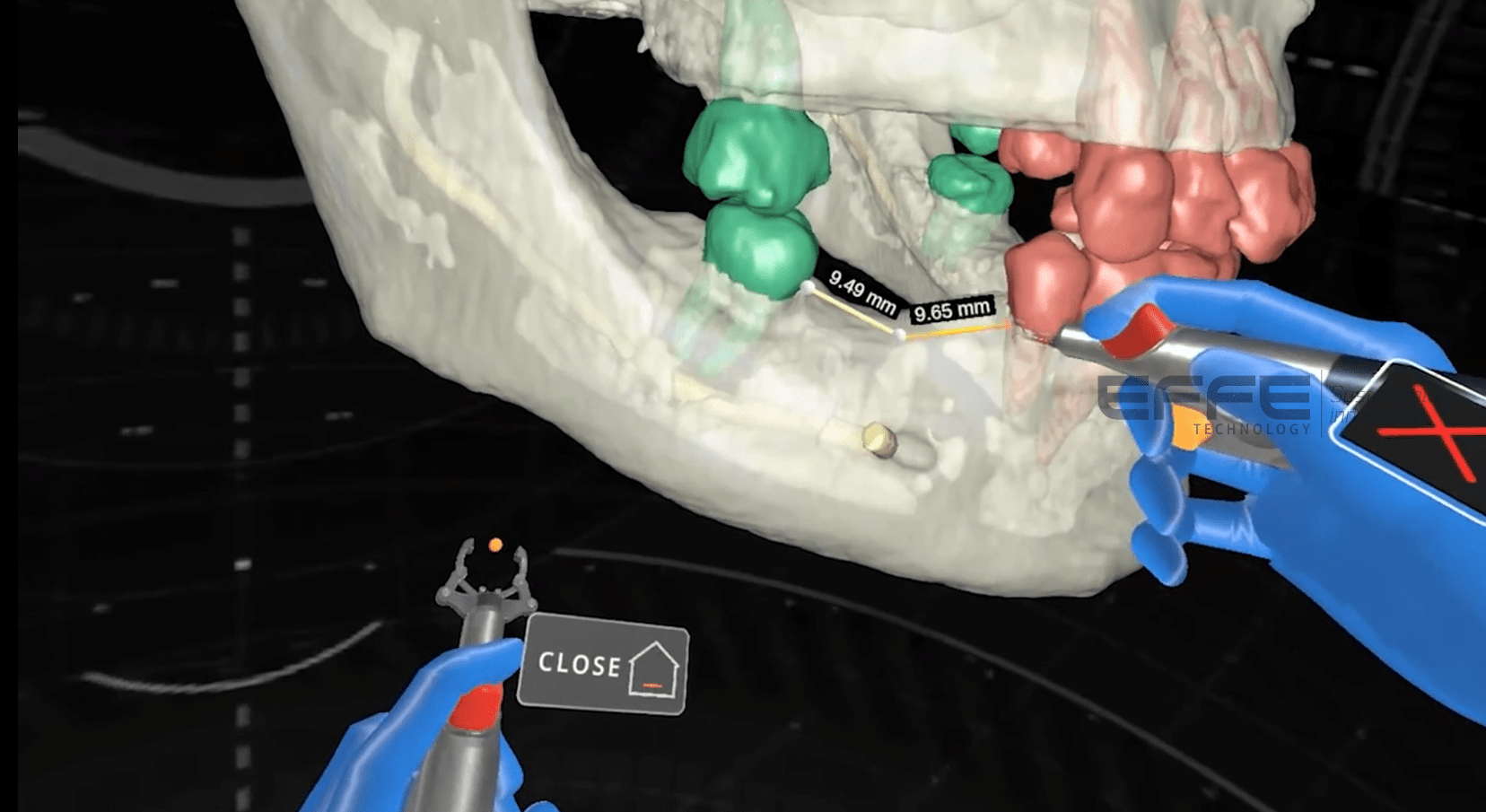 dental surgery VR simulation