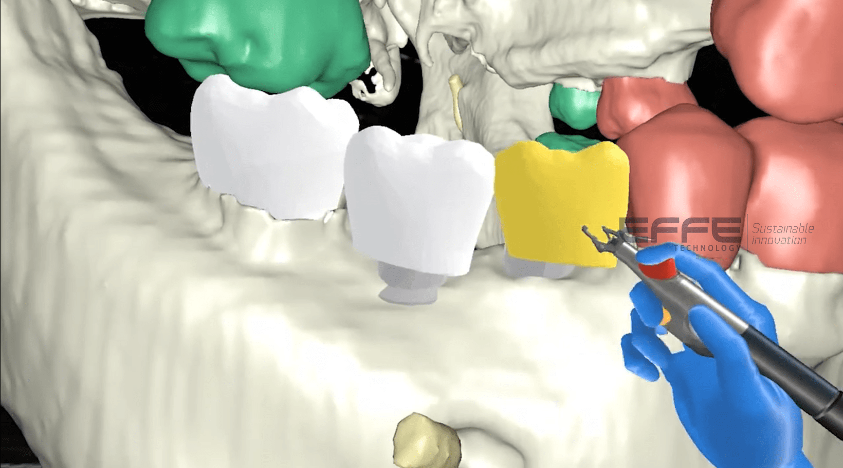 dental surgery VR simulation