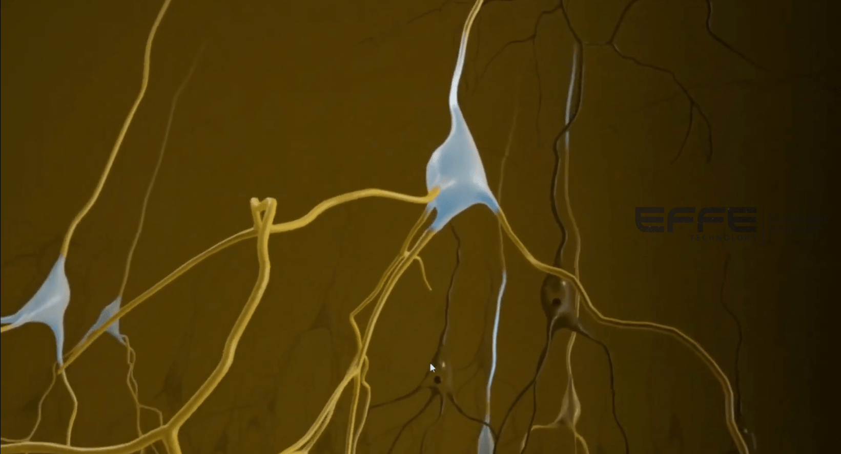  neurological pathophysiology VR