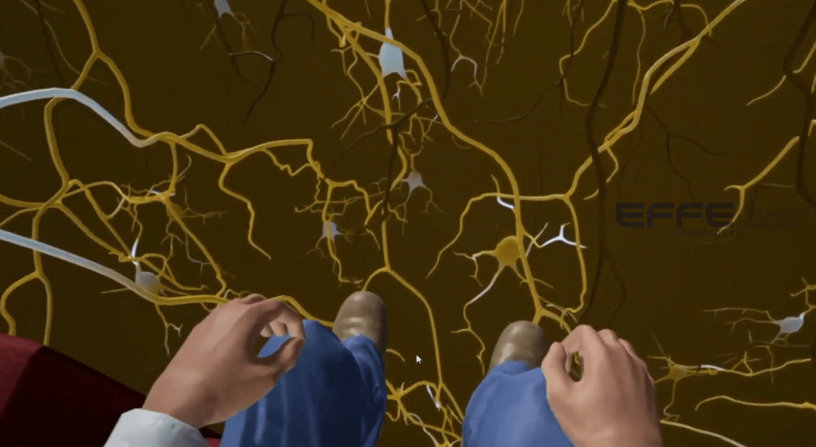 neurological pathophysiology VR